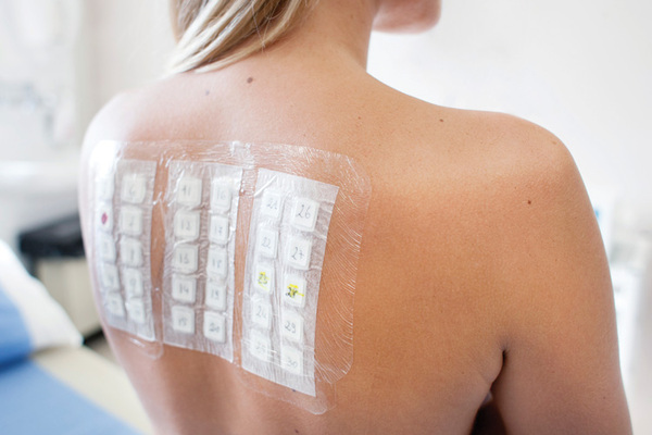 Allergy Testing