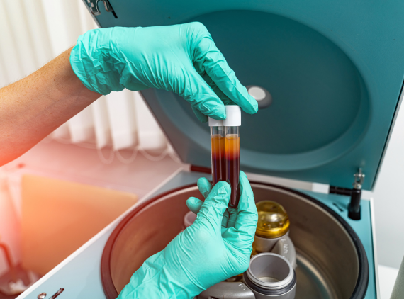 What Is PRP Therapy?